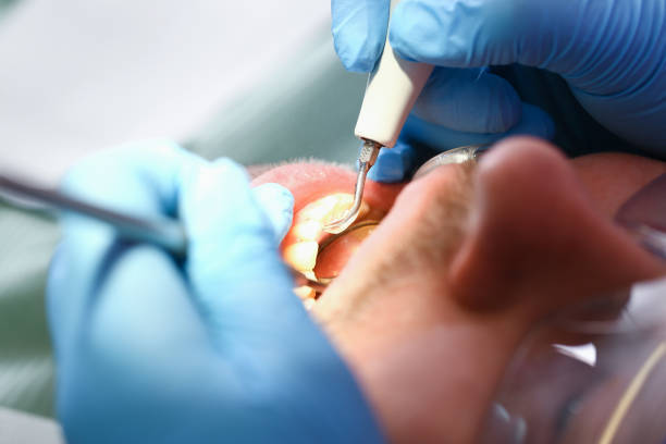 Best Urgent Dental Care for Toothache in Denver City, TX