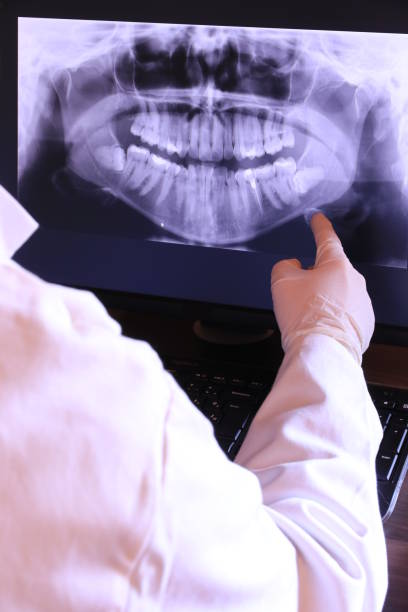 Best Emergency Dental Extractions in Denver City, TX