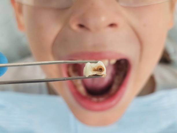 Best Broken or Cracked Tooth Emergency Dentist in Denver City, TX