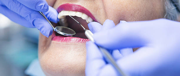 Best Emergency Dental Care for Abscessed Tooth in Denver City, TX